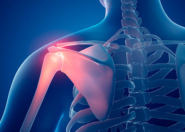 ü������� ȿ��